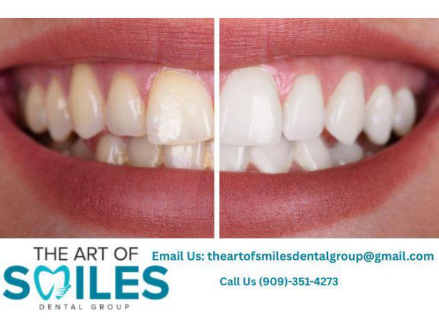 Dentist in Fontana | Trusted Local Dental Care Near You