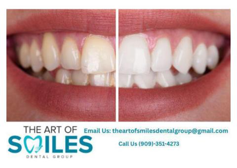 Dentist in Fontana | Trusted Local Dental Care Near You