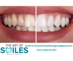 Dentist in Fontana | Trusted Local Dental Care Near You