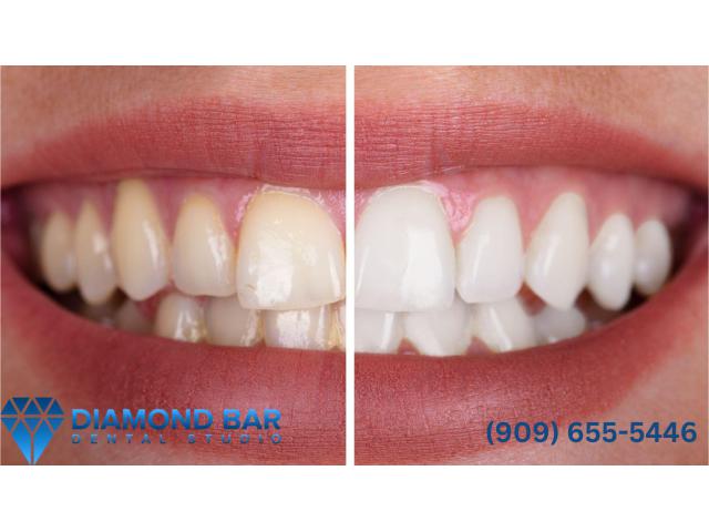Diamond Bar dental group Diamond Bar, CA