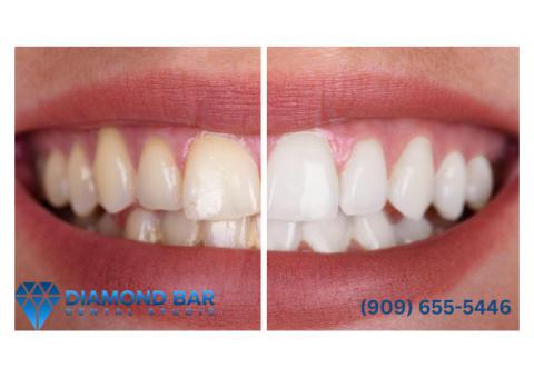 Diamond Bar dental group Diamond Bar, CA