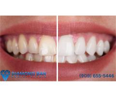 Diamond Bar dental group Diamond Bar, CA