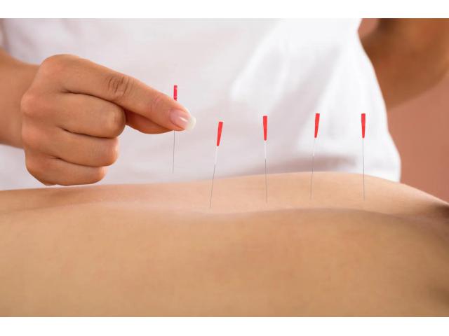 Physiotherapy Sylvan Lake