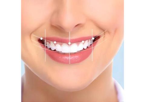 Best Smile Care Dental Clinic in Surat – Infismiles