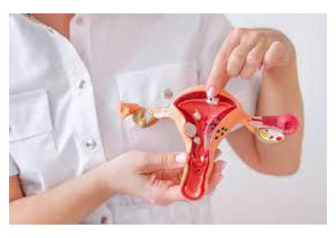 Advanced Uterine Fibroid Embolization for Women’s Health